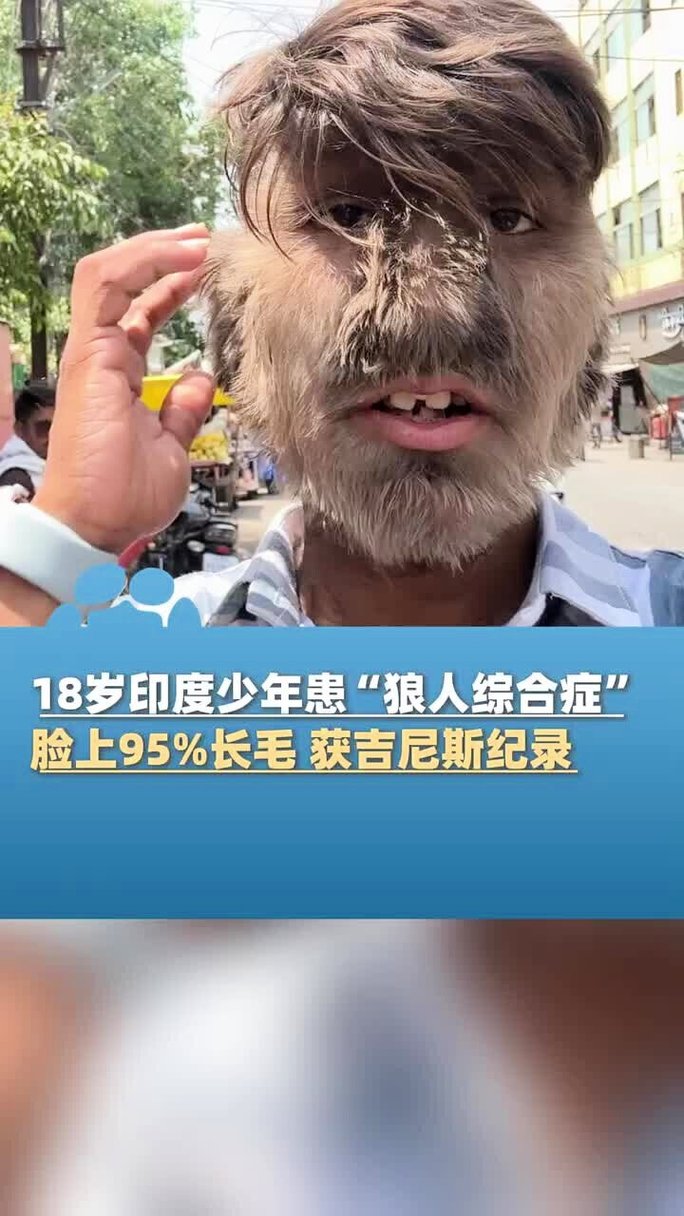 少妇偷拍综合的相关介绍